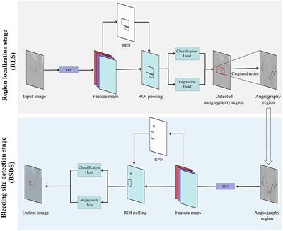 InterNet: Detection of Active Abdominal Arterial Bleeding Using Emergency Digital Subtraction Angiography Imaging With Two-Stage Deep Learning